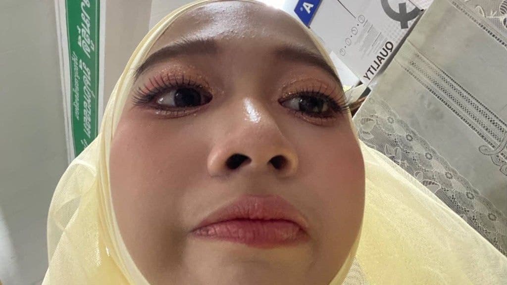 รูปเผลอ
